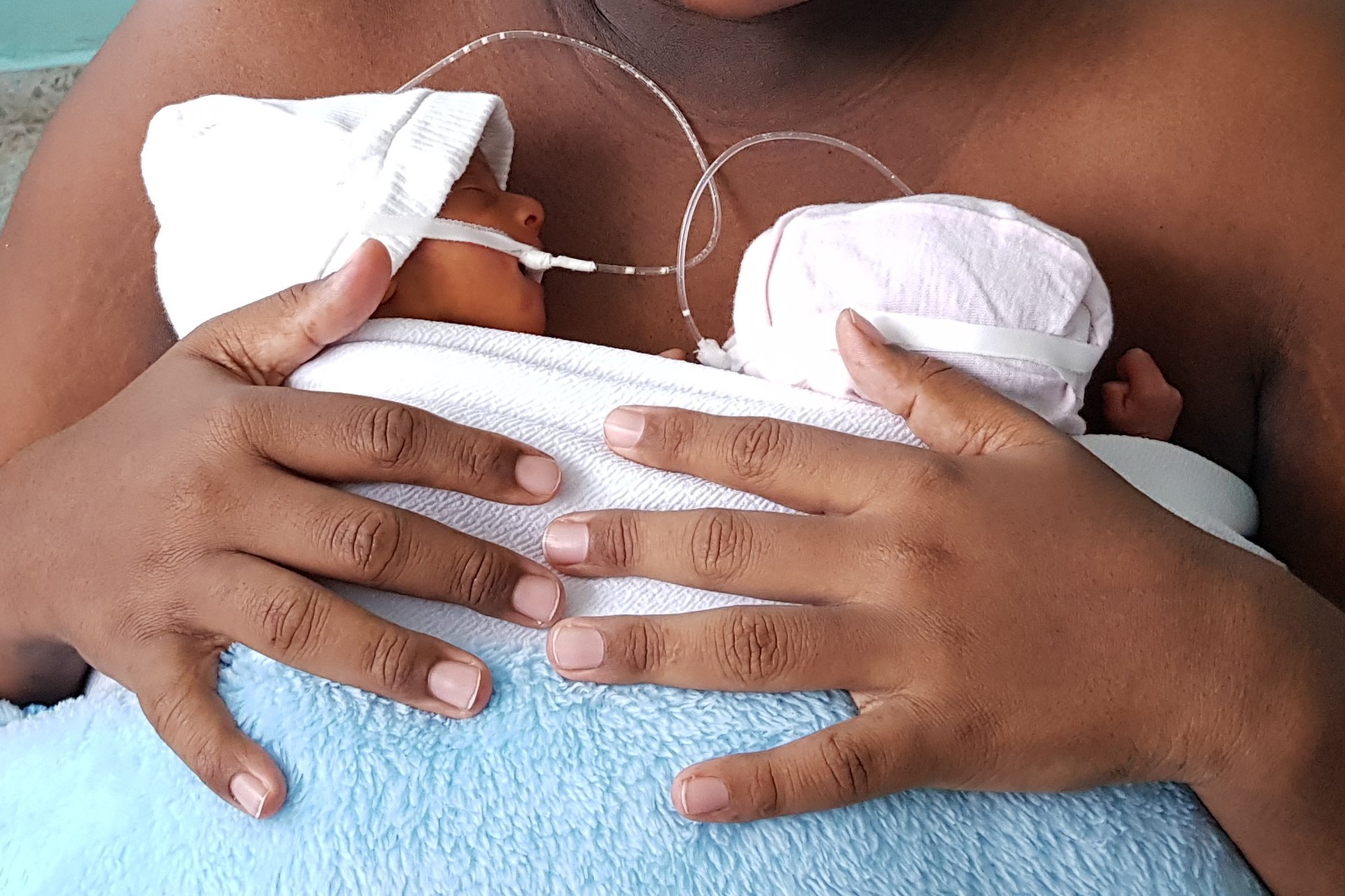 A mother practising kangaroo care with two preterm infants.