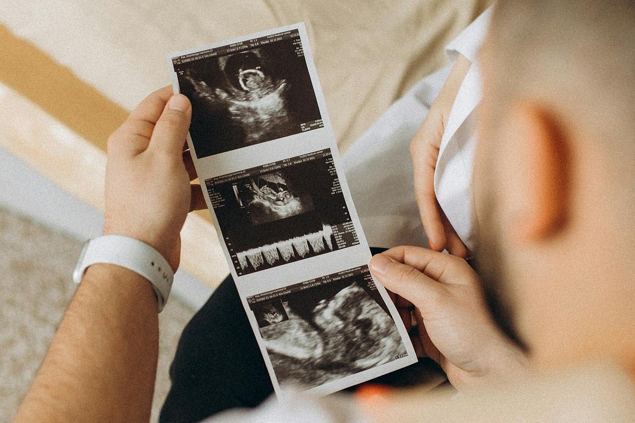 Close-up of hands holding ultrasound images of a baby.