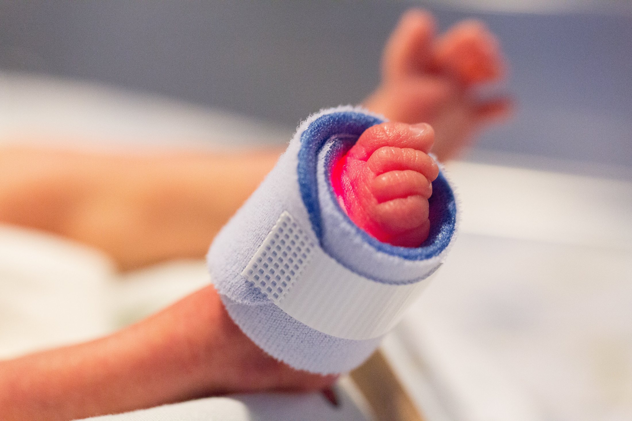 Close-up of a premature baby’s foot with a pulse oximeter attached.