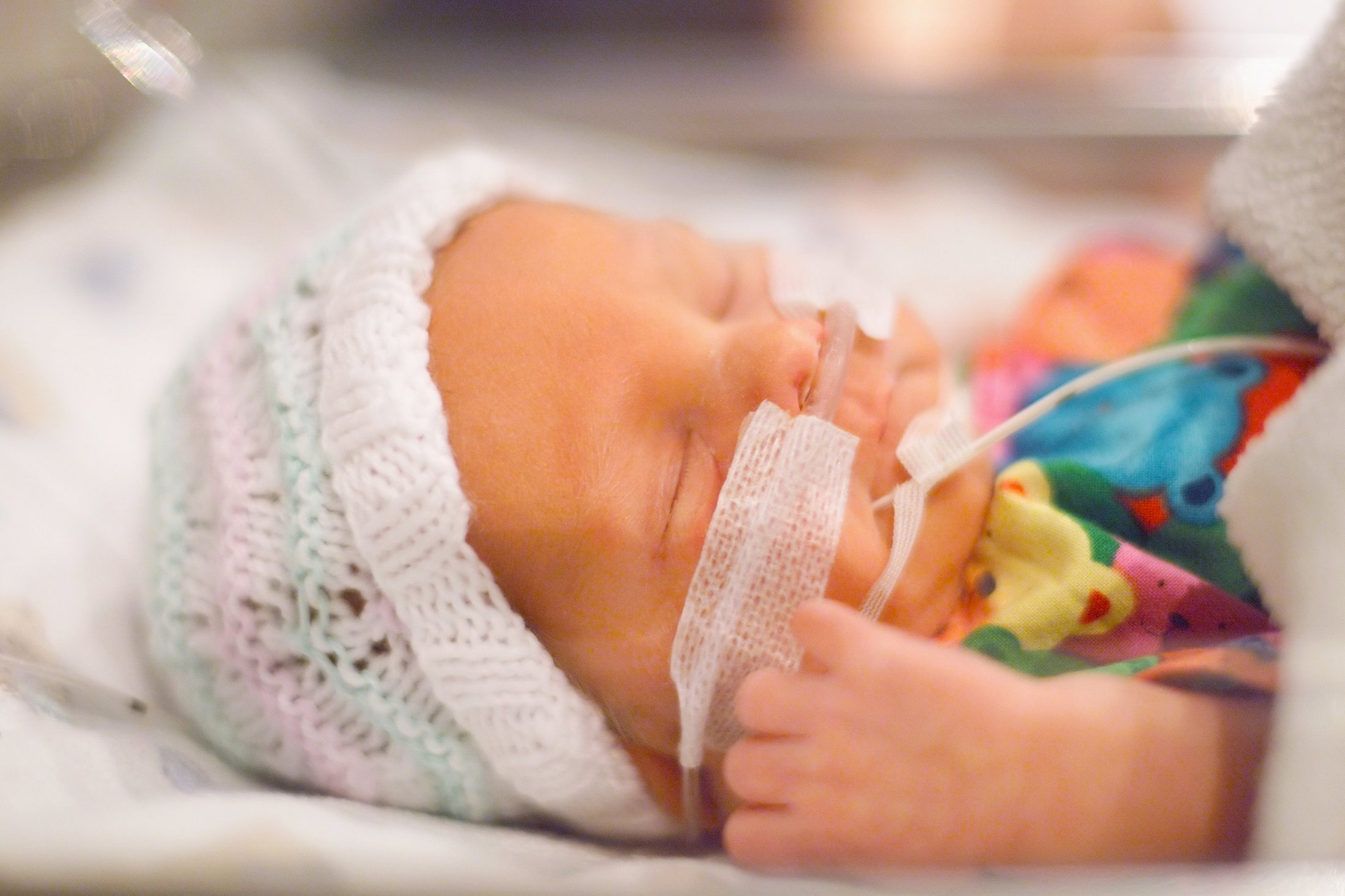 Premature baby wearing a knitted cap and breathing tube.