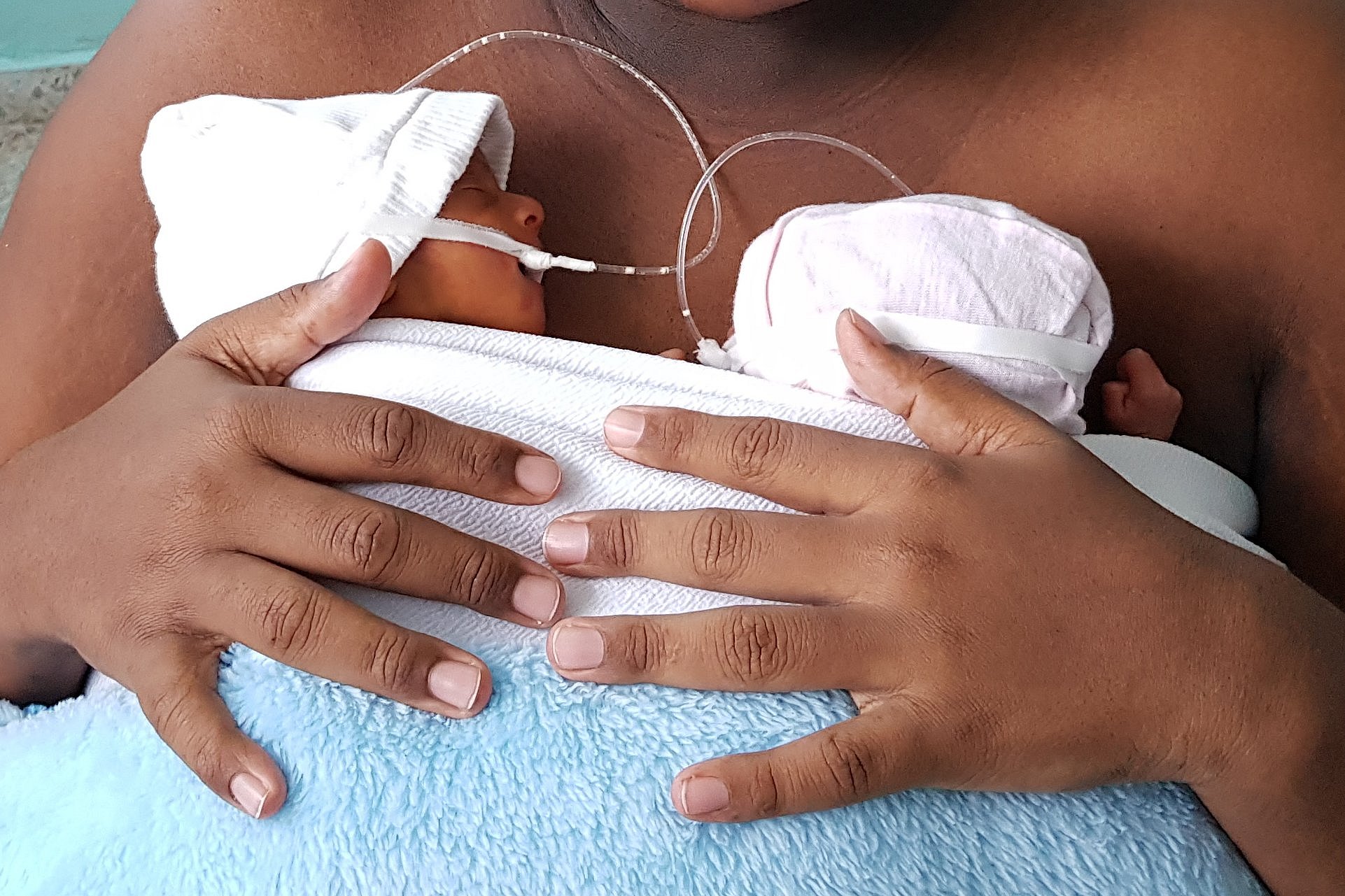 A mother practising kangaroo care with two preterm infants.