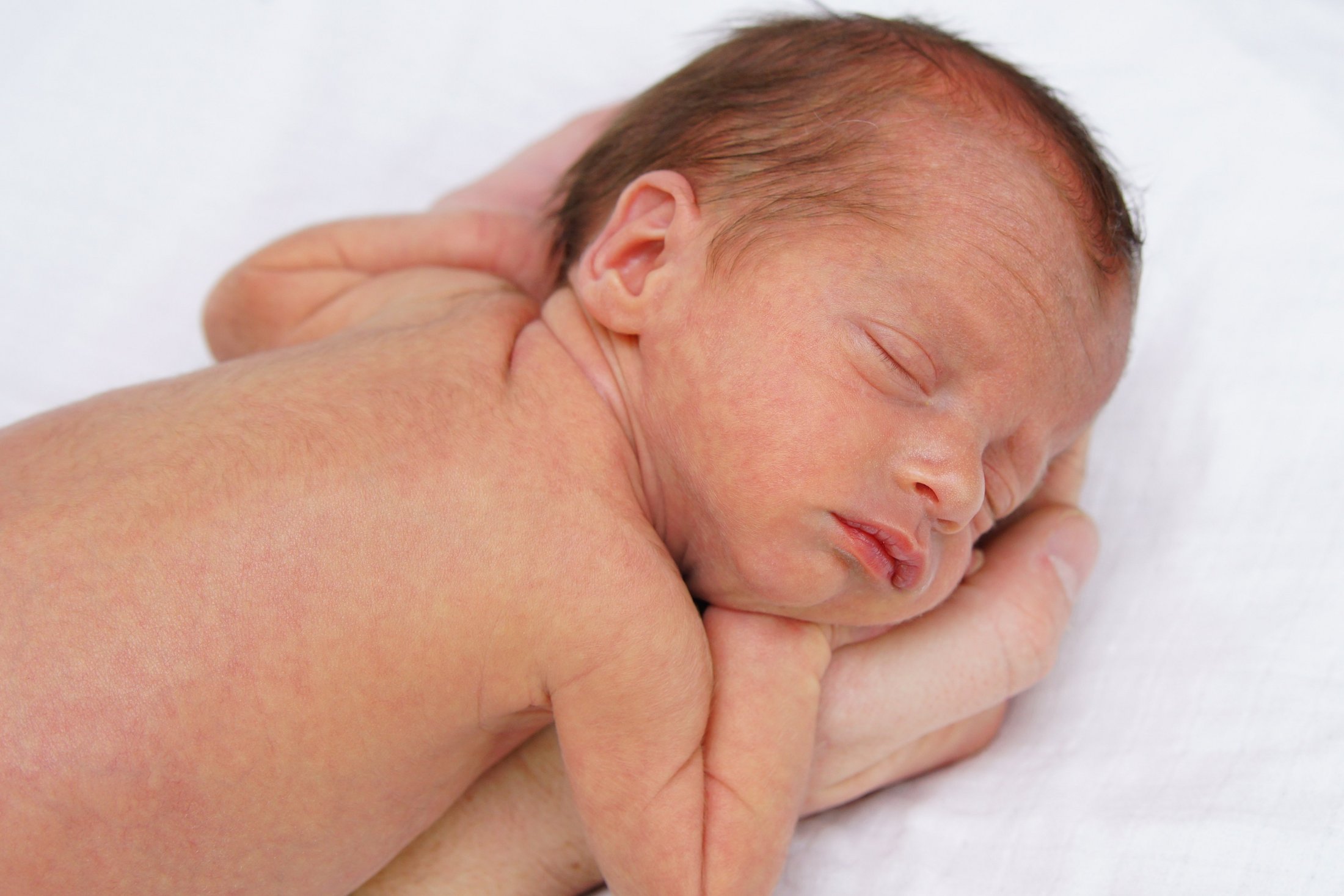 Premature baby sleeping on a supportive hand.
