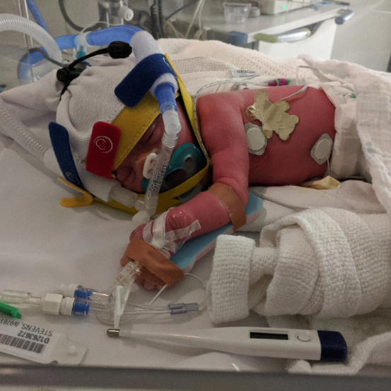 Laura, a former preterm baby, peacefully sleeping in a bassinet wrapped in a colorful knitted blanket.